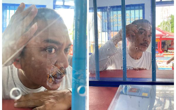 Foto: Robison Saul, saat menunjukan sisah memar di wajahnya kepada Pengacara yang mengunjunginya di Lapas Kelas IIB Tahuna. (Dok. Istimewa)